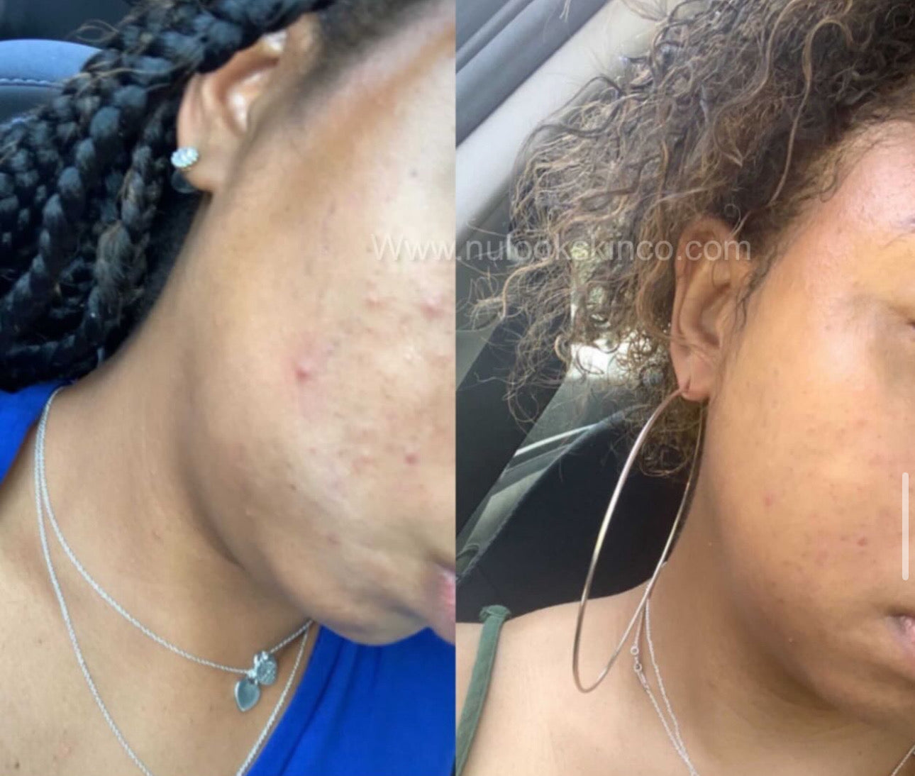 Clear Right Moisturizer
