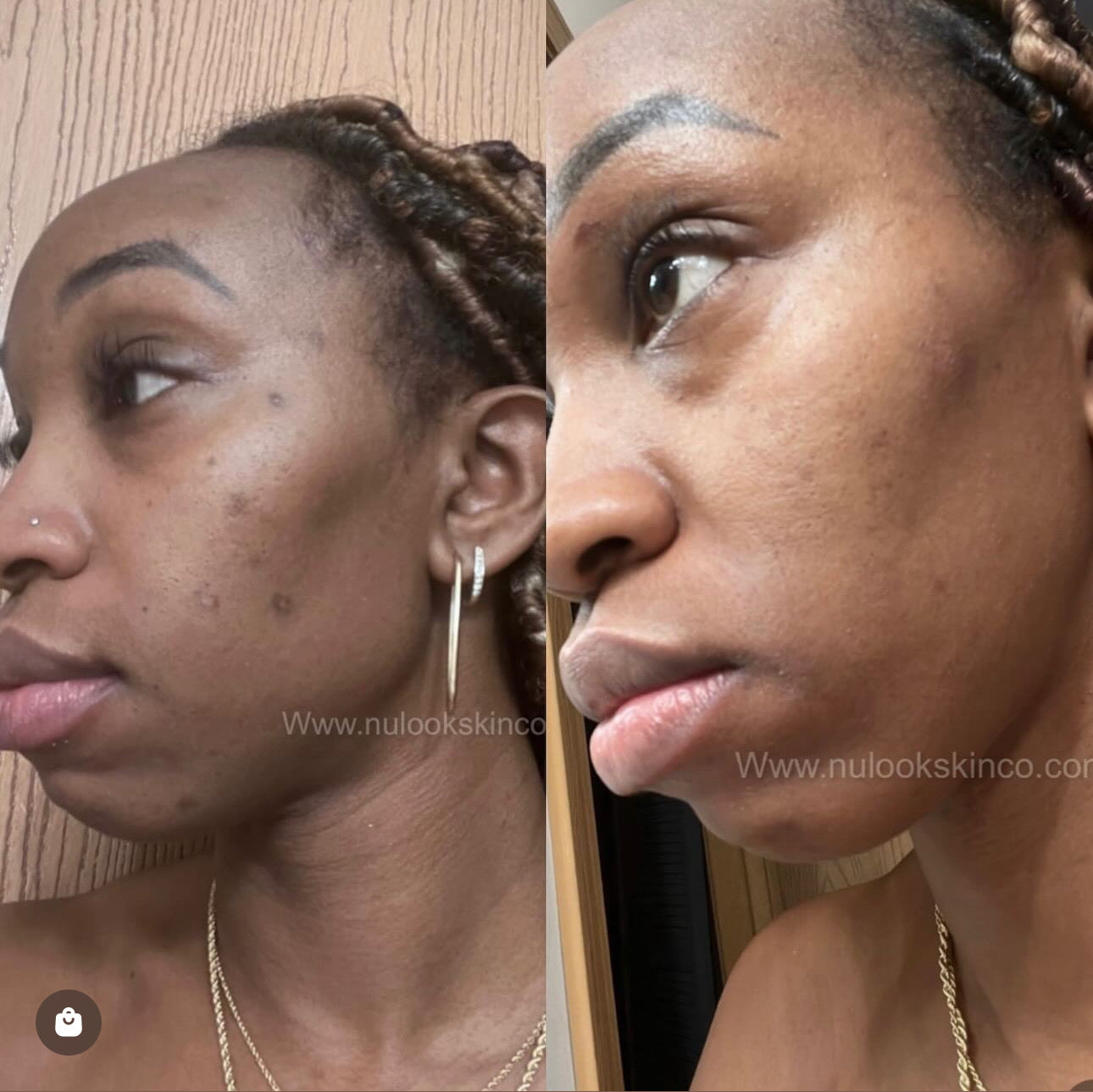 Clear Right Moisturizer